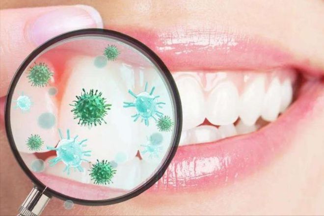 彩神牙结石不用洗牙！过来人分享生活小妙招！！(图2)